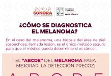 Atiende Gobierno de Sonora a 200 personas en primera jornada dermatológica