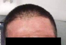 Asegura PESP a tres personas por posesión de sustancias prohibidas en HMO