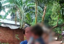 PERRO LE DESTROZO LA MANO A UN NIÑO EN YPANÉ CENTRAL PARAGUAY