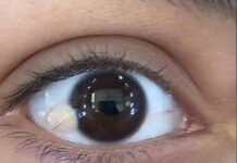 Joven se vuelve viral por mostrar como tiene que depilar su ojo.